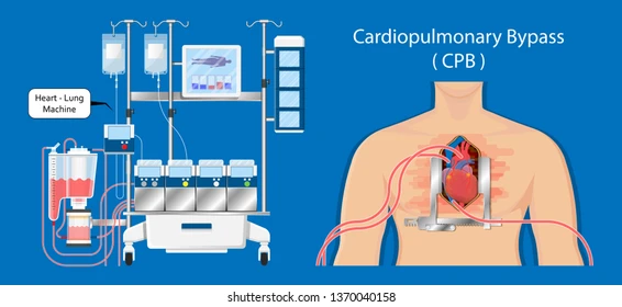 Heart lung machine